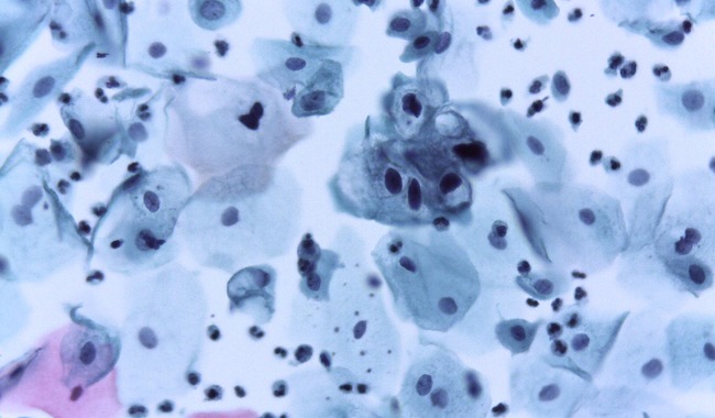 76ecd3930da9473db22db39ad4f99a1e